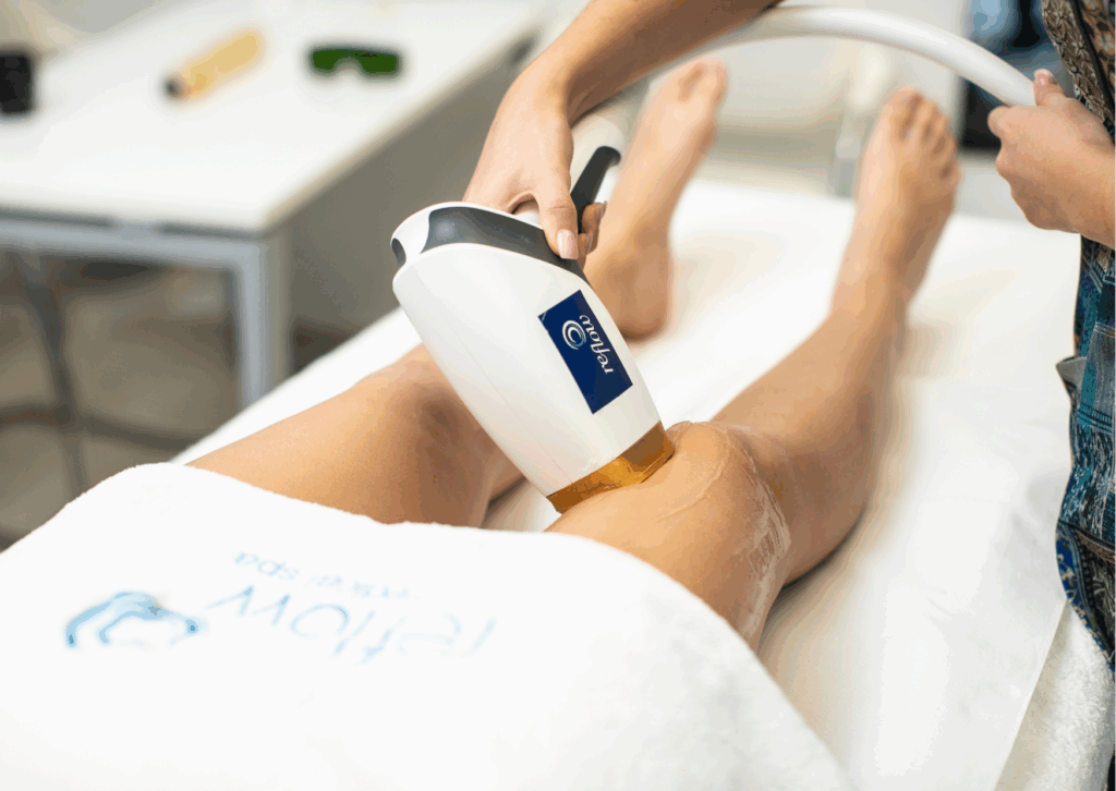 Epilazione Laser: Controindicazioni e Quando Evitarla