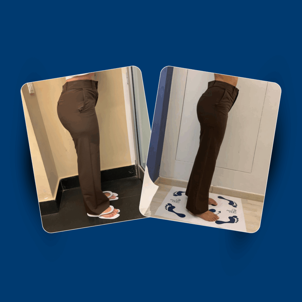 Rimodellamento Corpo: quali trattamenti funzionano davvero