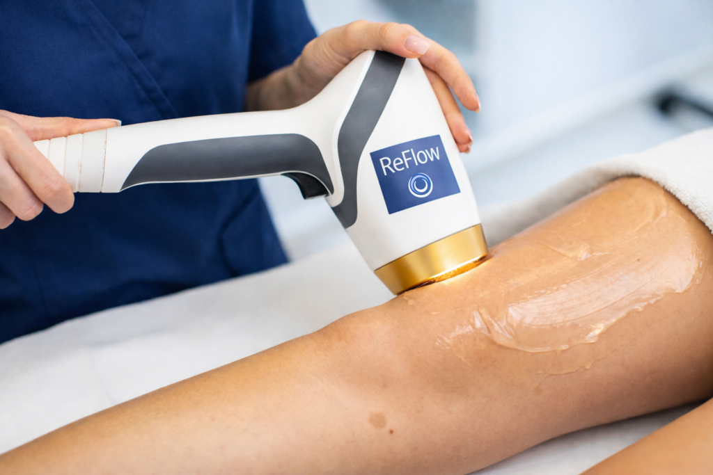 Epilazione laser: quando e perché non funziona